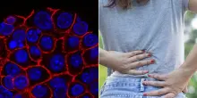 Tumore pancreas, come capire se il mal di schiena &egrave; un sintomo. L'oncologo: &laquo;Ecco quali sono i segnali da considerare&raquo;