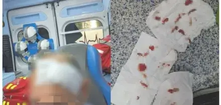Nocera Inferiore, passeggera senza biglietto aggredisce un controllore Busitalia: trauma cranico