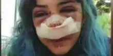 Ragazza picchiata a Bari per colpa di una pistola ad acqua, indagati l'addetta ai bagni del Parco e il suo compagno