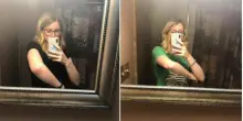 &laquo;Dolore al braccio dopo la palestra, pensavo fosse normale. Poi &egrave; arrivata la diagnosi: era la rara rabdomiolisi&raquo;