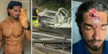 Marco Fatata, l'ex tentatore di Temptation Island e l'incidente con l'auto (distrutta dalle fiamme): &laquo;Un minuto mi ha stravolto la vita&raquo;