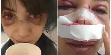 Accerchiata e picchiata al parco, Giuditta D'Elia denuncia una nuova aggressione: &laquo;Mi hanno urlato che me lo meritavo&raquo;