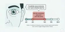 Colesterolo alto, i sintomi da intercettare guardandosi allo specchio: dalle palpebre all'iride a cosa fare attenzione