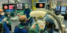 Criobiopsia, nuove prospettive per la diagnosi delle malattie rare del polmone