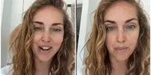 Chiara Ferragni: &laquo;Un ex voleva convincermi a rifare il seno. I ritocchini? S&igrave;, faccio il botox, ma mi sono pentita di alcuni trattamenti&raquo;