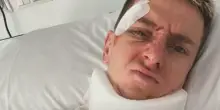 Pogacar, come sta dopo la caduta alla Vuelta: la foto dall'ospedale, la commozione cerebrale e le fratture. La stagione &egrave; a rischio