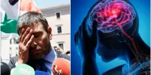 Di Battista e i forti dolori alla testa, la neurologa: &laquo;Ecco le possibili cause&raquo;. Sintomi e quando la cefalea deve preoccupare
