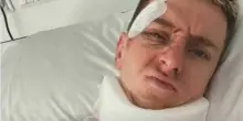 Poga?ar, il post dall?ospedale con ?Stayin? Alive?: come sta dopo la caduta