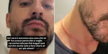 Mr. Daniel, il make up artist dei vip aggredito e rapinato a Milano: &laquo;Mani al collo e mi hanno strappato con forza le collane&raquo;