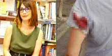 &laquo;Colpita da un proiettile vagante a Roma, in zona Prati. Attenzione c'&egrave; un uomo che spara con pistola ad aria compressa contro donne e turiste&raquo;