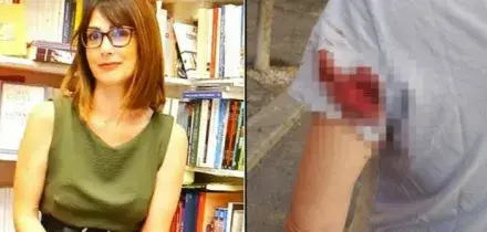 Paura a Roma, quartiere Prati: donna ferita da un proiettile, indagini dopo altri spari contro donne e turiste