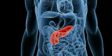 Tumori "freddi", scoperte le molecole che possono aiutare l'immunoterapia: cosa dice lo studio