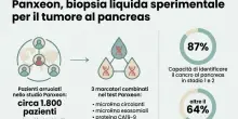 Tumore al pancreas, un nuovo test del sangue per la diagnosi precoce: &laquo;Rivela 3 marcatori, potrebbe individuare lo stadio zero&raquo;
