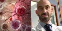 Morbillo, l'allarme di Matteo Bassetti: &laquo;Siamo all'inizio di una gravissima epidemia&raquo;. Le complicanze per polmoni, fegato e sistema nervoso