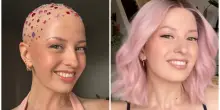 &laquo;Ho l'alopecia da quando avevo 6 anni, indossavo parrucche ogni giorno perch&eacute; mi vergognavo. Poi una festa a tema calvizie ha cambiato tutto&raquo;