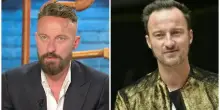 Francesco Facchinetti: &laquo;Contro la calvizie indosso una patch cutanea. Il trapianto di capelli? Ho provato un male atroce&raquo;