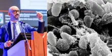 Peste polmonare, allarme in Europa. Bassetti: &laquo;Assomiglia al Covid, ti contagi in 2 giorni. Non c'&egrave; vaccino&raquo;. Sintomi e come si trasmette