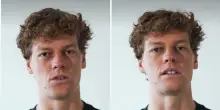 Sinner, stagione finita e niente ATP Finals a Torino: &laquo;Devo curare il ginocchio, penso alla mia carriera. Far&ograve; il possibile per tornare al 100%&raquo;
