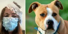 &laquo;Un cane Amstaff mi ha azzannato alla testa mentre ero al bar, mi ha lesionato il cuoio capelluto. La dog sitter poi &egrave; scappata&raquo;