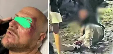 Napoli, padre picchiato al Vomero: 10 ragazzini identificati, ci sono anche i figli di due poliziotti