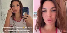 Elettra Lamborghini, il viso gonfio preoccupa i fan: &laquo;Ho fatto un laser bello forte&raquo;. I problemi dopo la pillola anticoncezionale