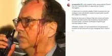 Scontri a Milano, il dirigente della polizia Angelo De Simone ferito alla testa resta in piazza: l'omaggio di Meloni