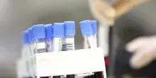 Morbo di Crohn e colite, gli anticorpi nel sangue svelano la malattia 10 anni prima: la svolta in una ricerca olandese