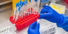 Gli Usa avvertono, 'laboratori biologici in Ucraina sono a rischio'