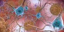 Allo studio nuovi sensori per leggere il cervello neurone per neurone