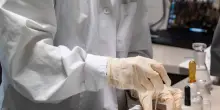 Hantavirus, rischio per polmoni e reni ma il pericolo &egrave; limitato
