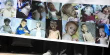 Governo Gaza, 100.000 bimbi rischiano di morire a breve