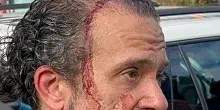 Modena, il racconto di Luca Signorelli: 'Mi sono arrivati due fendenti, cos&igrave; l'ho neutralizzato'