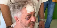 Lo chef ferito a Modena: "Ho visto l'auto partire e ho pensato '&egrave; matto'"