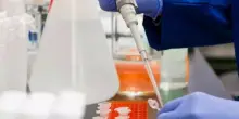 Esperto, a 40 anni dalla scoperta dell'Hiv ancora milioni di persone infettate e nessun vaccino