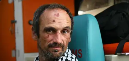 La denuncia degli attivisti, 'Botte, catene e abusi sessuali'