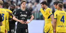 Juve: problemi muscolari per Yildiz: derby a rischio