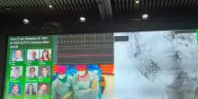 Chirurghi di Padova operano in diretta streaming al congresso di New York
