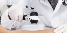 Il vaccino contro il melanoma mostra risultati promettenti, Moderna vola in Borsa a +102%