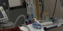 A Verona una madre dona il rene alla figlia affetta da fibrosi cistica