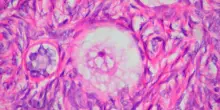 L'ovaio non va in pensione, dopo la menopausa continua a cambiare