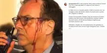 Il poliziotto ferito al lavoro: 'Dobbiamo garantire la sicurezza'
