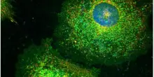 Le cellule tumorali diventano zombie per sfuggire alla chemioterapia