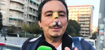 Prof lo interroga, studente 14enne gli frattura il naso a pugni