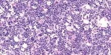 Spento l'allarme che fa invecchiare le cellule del sangue