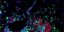 Identificate le cellule che costruiscono gli avamposti anticancro