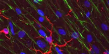 Fra i 50 e i 75 anni il cervello cambia, perde cellule immunitarie