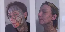 Costrette a tatuarsi dai partner violenti, in Olanda le vittime cancellano i marchi