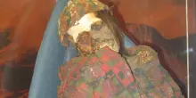 Nelle mummie cilene le prove che il vaiolo fu portato dai colonizzatori