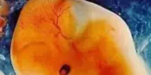 Scambio di embrioni al San Raffaele. Gli ispettori: "Serve un sistema anti errore"