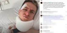 Vuelta: Pogacar pubblica la foto dall'ospedale, cerotti, smorfia e 'Stayin' alive'